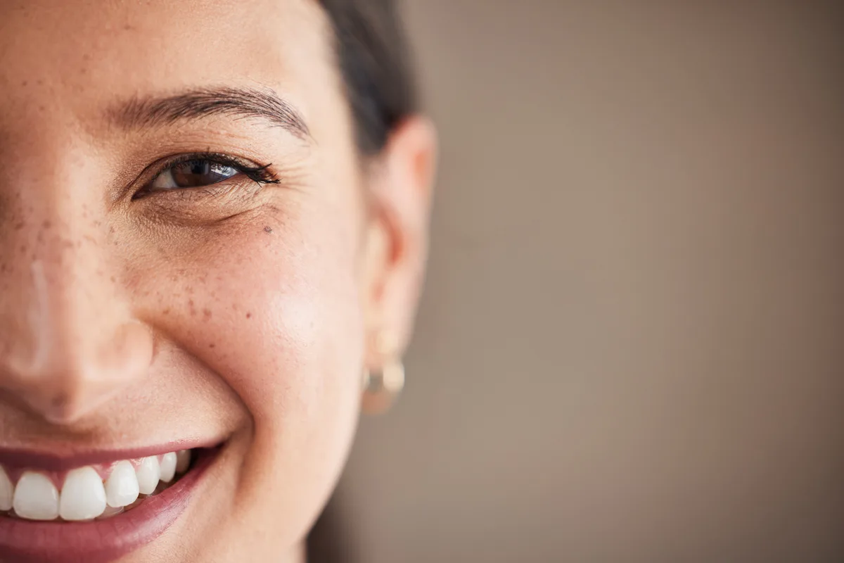 A bright, confident smile after cosmetic veneers and whitening