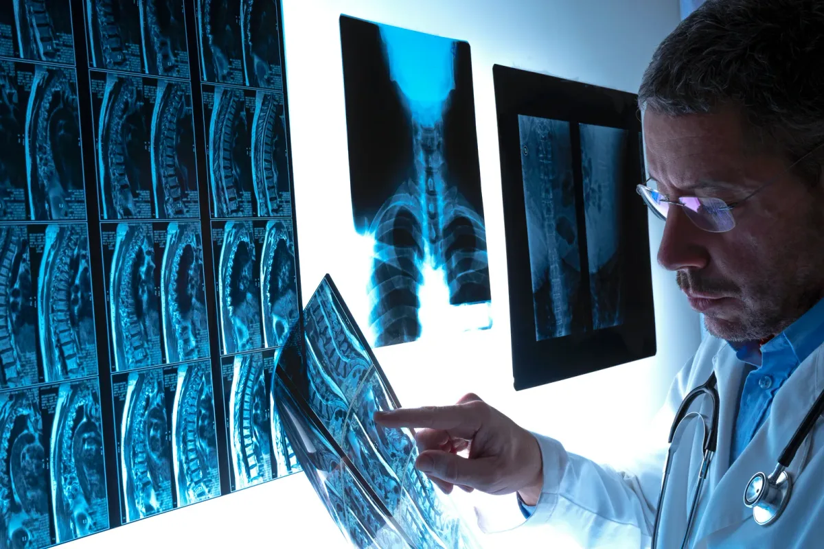 Spine surgeon reviewing a patient's MRI scan of the spine during a consultation