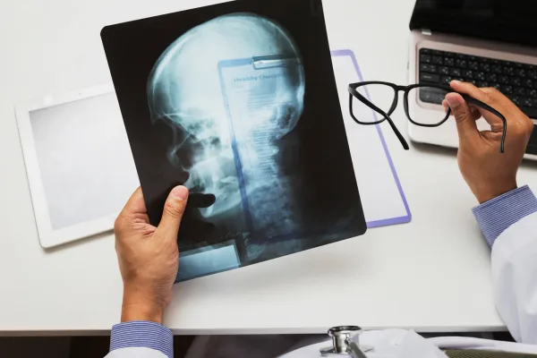 Neurologist discussing a brain scan with a patient during an office visit