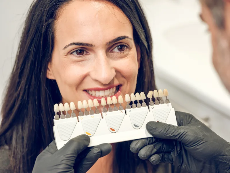 Dentist holding a porcelain shade guide beside a smiling woman to compare tooth colours