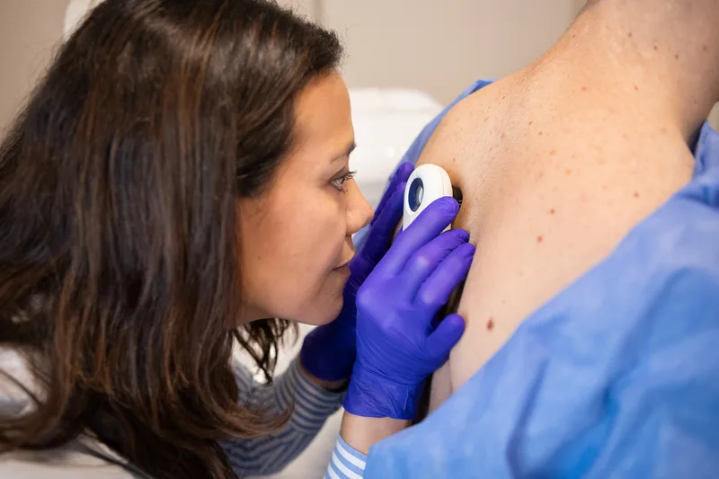 Dermatologist examining the freckled skin of a patient's shoulder through a handheld dermatoscope