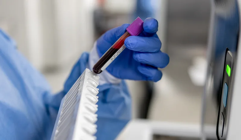 A technician in blue gloves holds up a blood sample tube beside a rack of samples