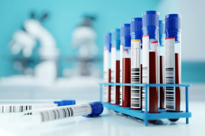 Rows of labelled blood sample tubes standing in a blue rack on a lab bench