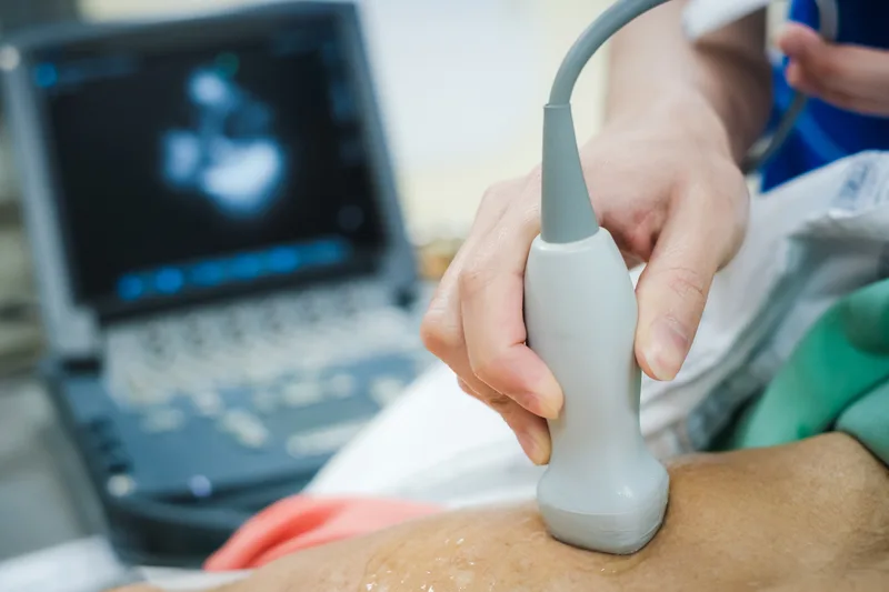 A sonographer's hand guides an ultrasound probe during an echocardiogram, monitor in the background