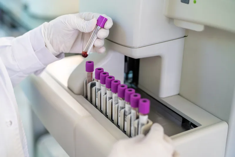 A gloved technician loads labelled blood-sample tubes into a laboratory analyser