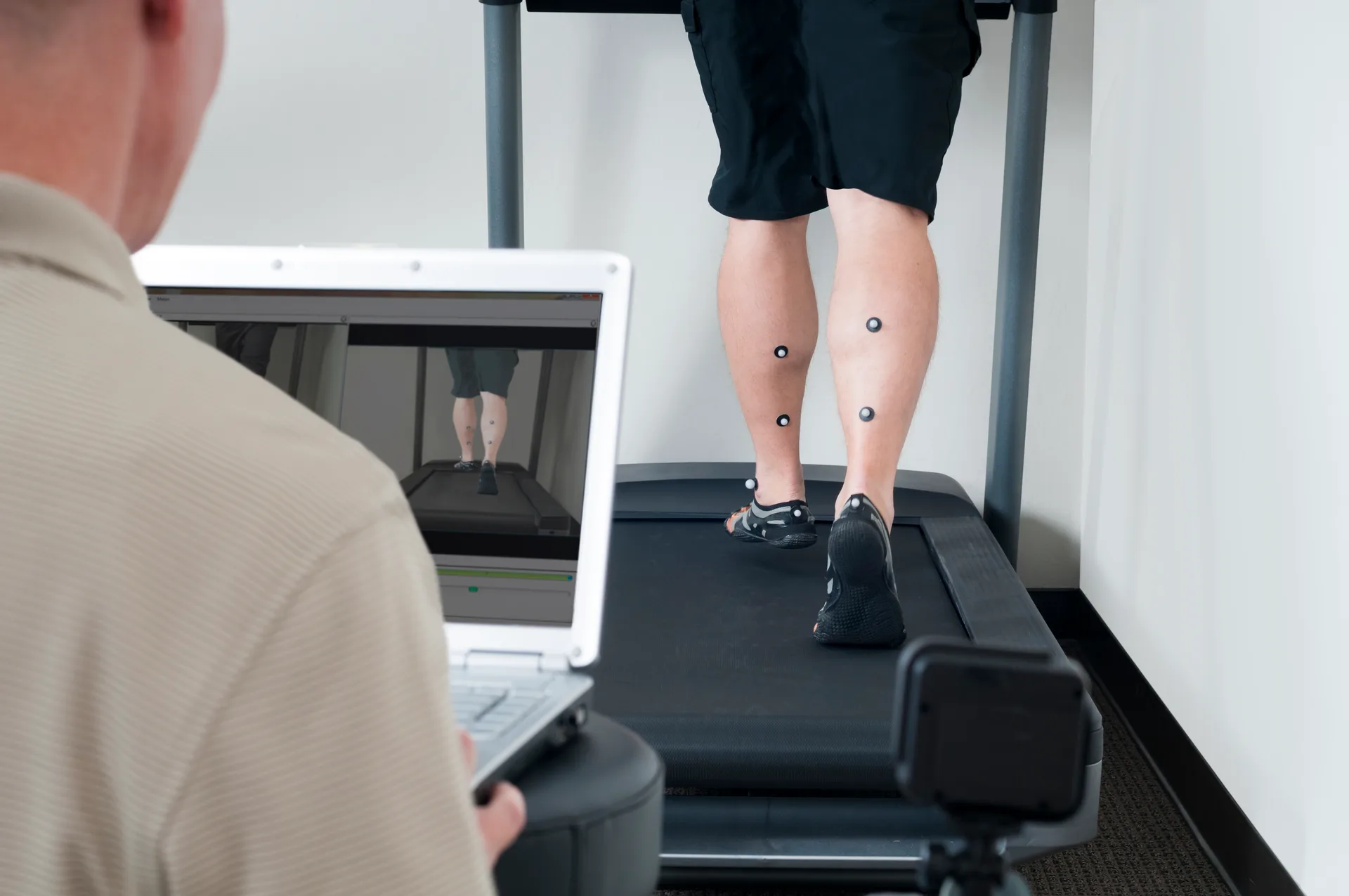 Clinician reviewing motion-capture markers on a runner's calves during a treadmill video gait analysis