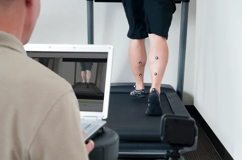 Clinician reviewing motion-capture markers on a runner's calves during a treadmill video gait analysis