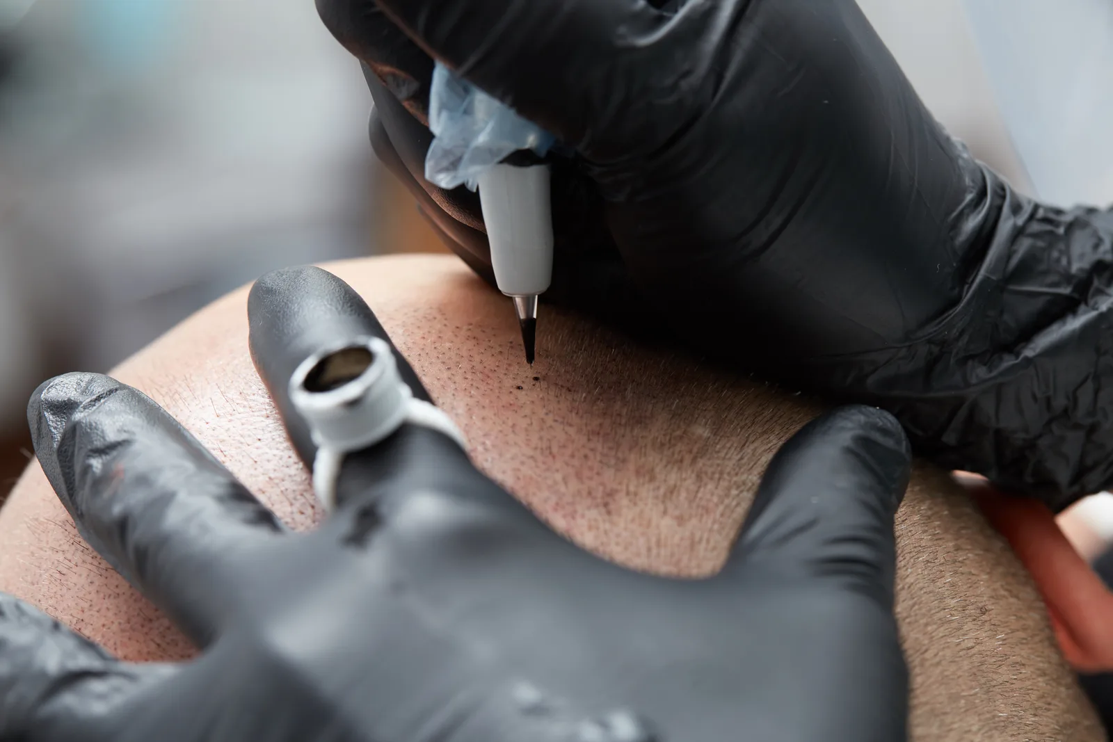 SMP practitioner using a micro-needle device to layer pigment dots along a client's hairline in a studio
