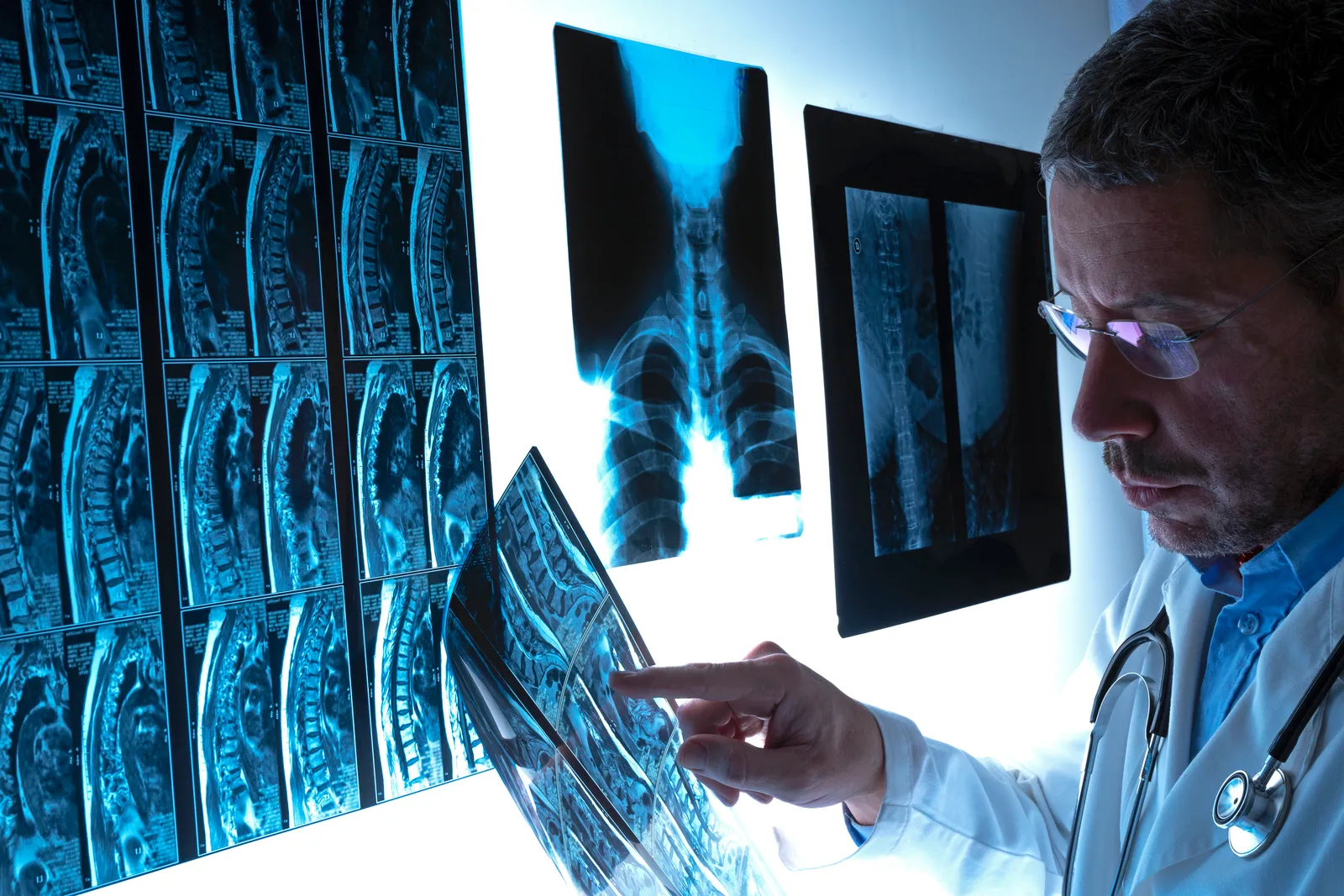 Spine surgeon reviewing a patient's MRI scan of the spine during a consultation