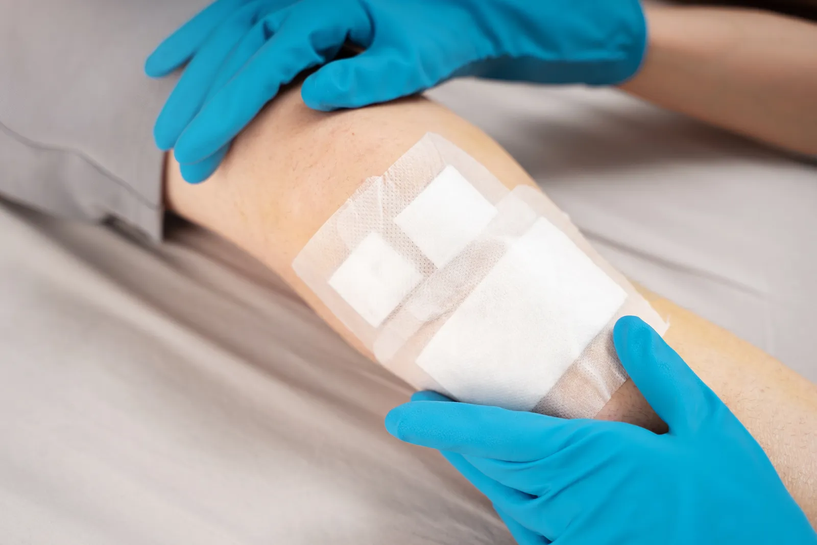 Wound care nurse changing a dressing on a patient's lower leg wound in a clinic treatment room